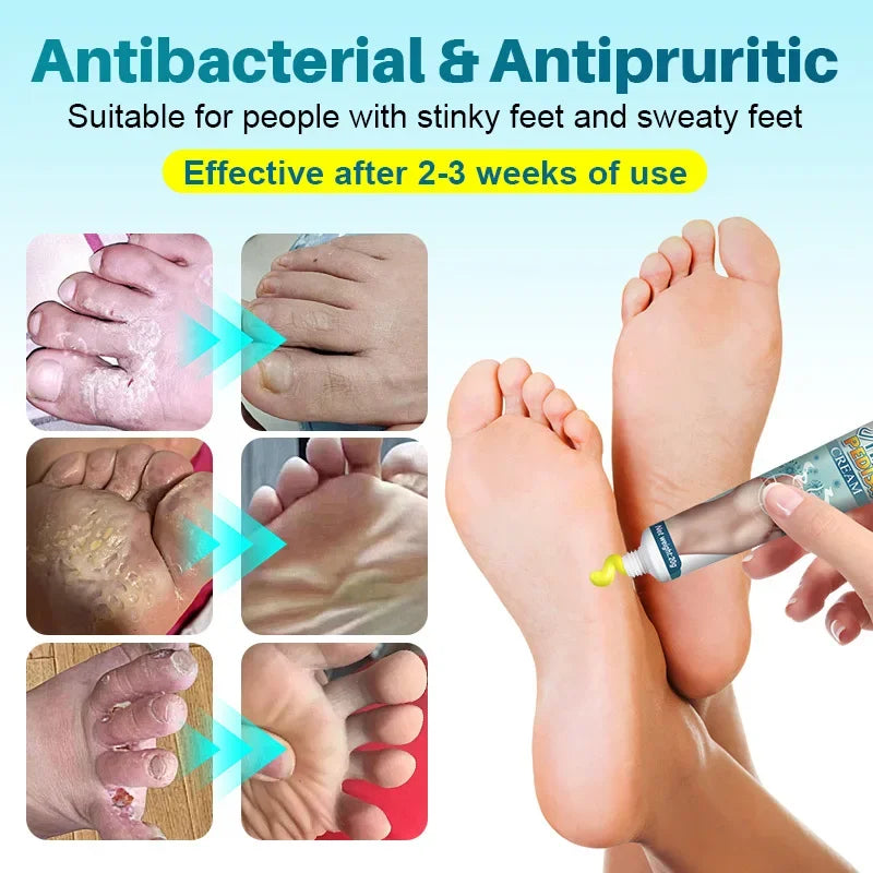Foot Deodorant Cream Foot Odor Bacteriostasis Antipruritic Athlete's Foot Ointment Skin Topical Cream Personal Health Care