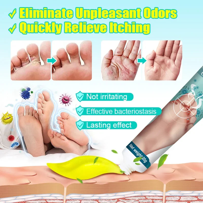 Foot Deodorant Cream Foot Odor Bacteriostasis Antipruritic Athlete's Foot Ointment Skin Topical Cream Personal Health Care