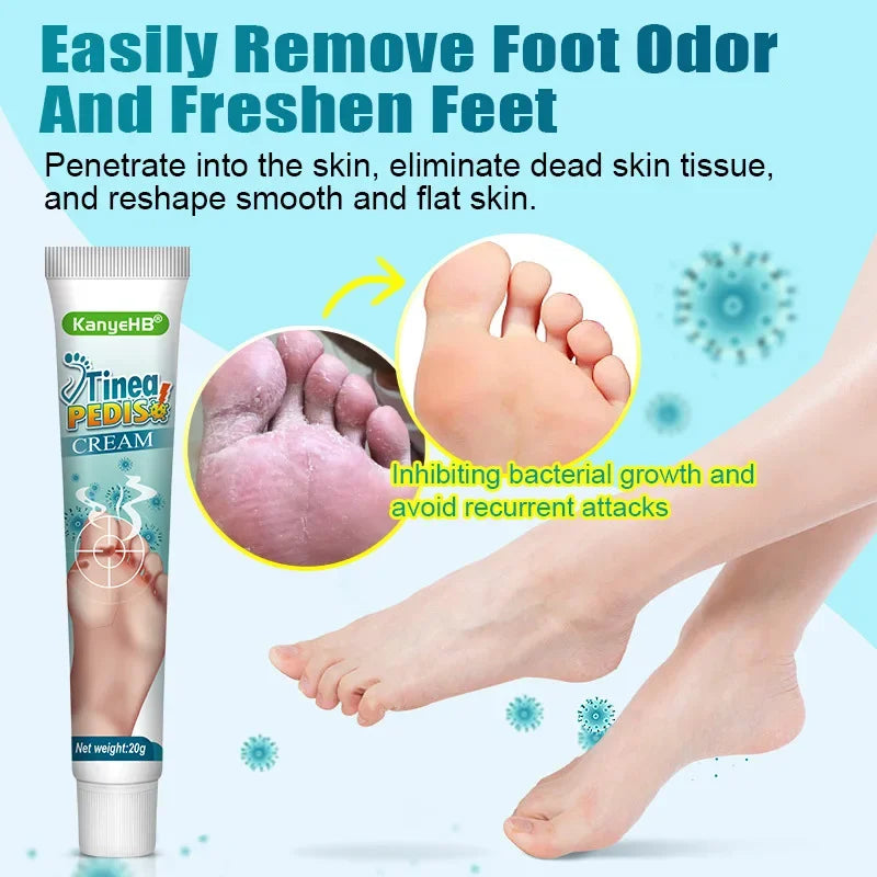 Foot Deodorant Cream Foot Odor Bacteriostasis Antipruritic Athlete's Foot Ointment Skin Topical Cream Personal Health Care